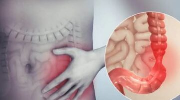 في شهر التوعية.. مشروبات طبيعية لتهدئة القولون