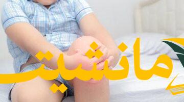 هل يعاني طفلك من آلام نمو؟  العلامات التي يجب مراقبتها وكيفية التعامل معها.