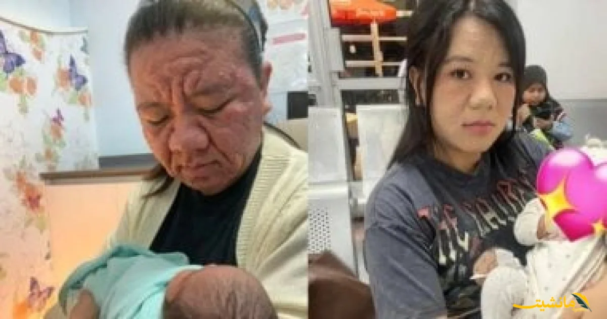 ظهور نادر.. ماليزية في الـ28 من عمرها تشيخ 40 عامًا خلال الحمل