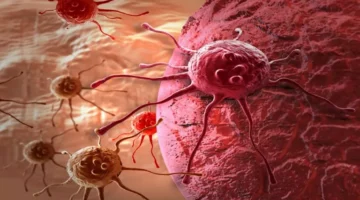 صحة ووقاية.. أطعمة بسيطة تقلل خطر السرطان حتى 60%