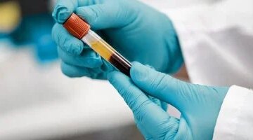 اختبار دم جديد يحدد مسار الشيخوخة الصحية ويتنبأ بمخاطر الأمراض