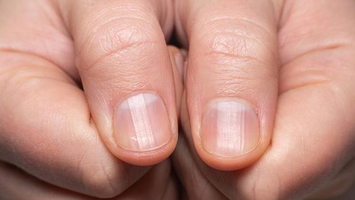 تعرف على علامات الأظافر التي قد تكشف مشكلات صحية خطيرة